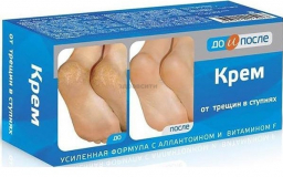 До и После Крем от трещин в ступнях 150 мл